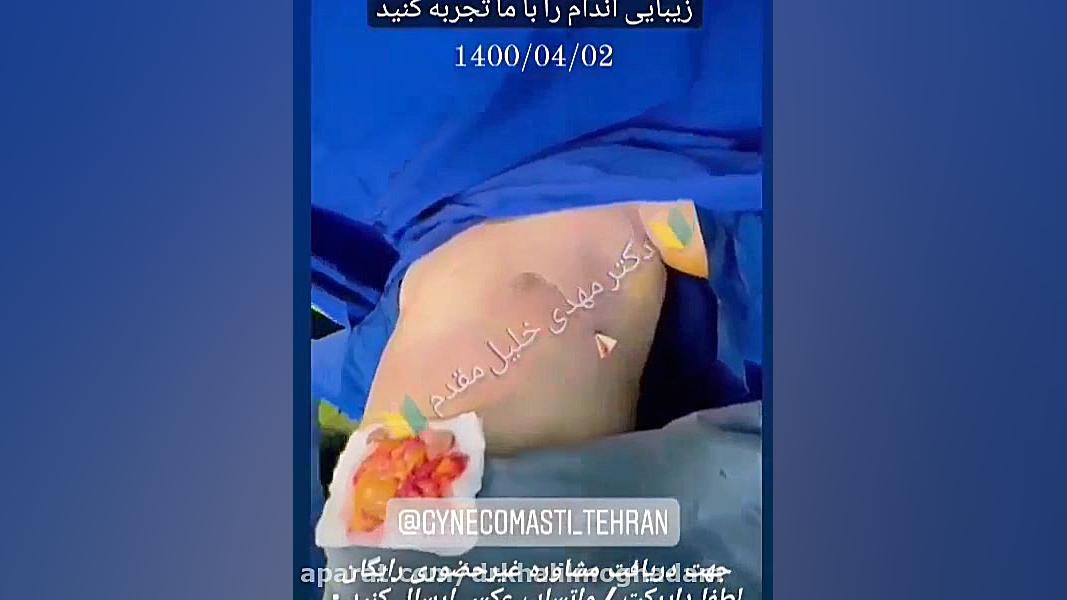 انجام کلیه جراحی های پیکرتراشی و لاغری توسط دکتر مهدی خلیل مقدم دکتر مهدی خلیلی مقدم