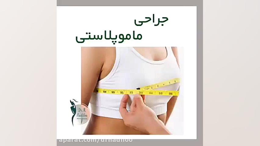 انیمیشن ماموپلاستی ترومبوسیتوپنی مقاوم