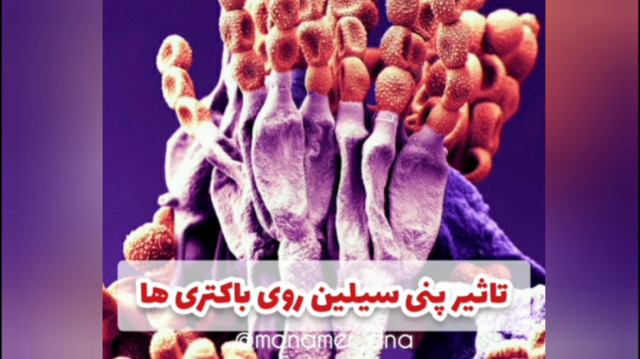 تاثیر پنی سیلین در نابودی باکتری ها عصب‌کشی