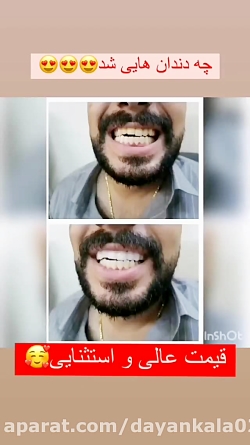 لمینت متحرک اعلا آلمانی 09384828036 سفارش: واتساپ