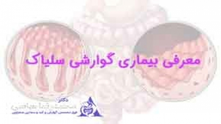 همه چیز درباره بیماری سلیاک تزریق بوتاکس