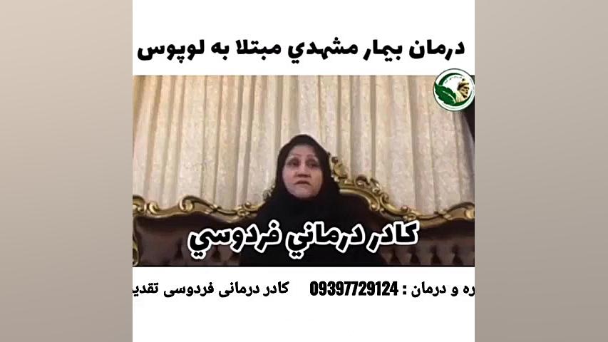 درمان تضمینی لوپوس پروتز دندان