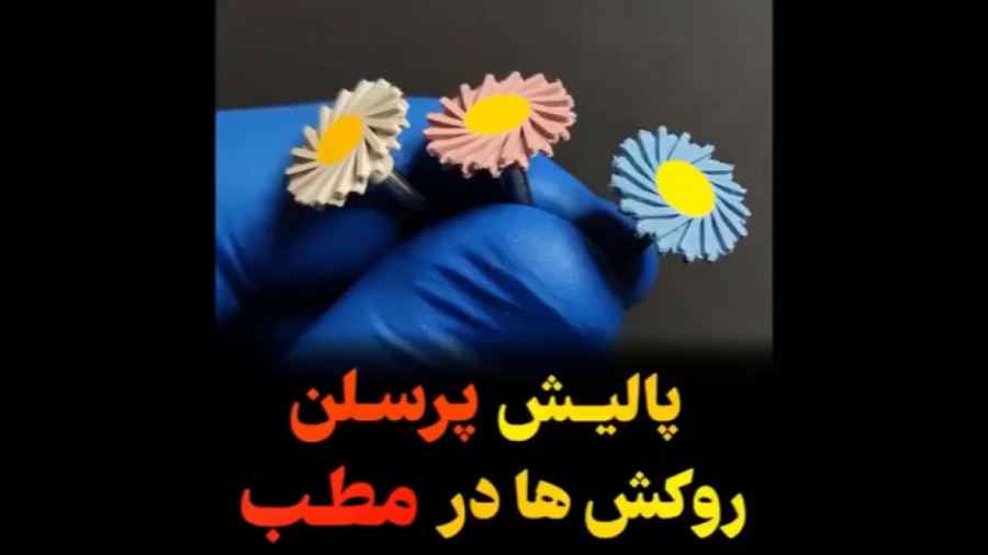 پالیش پرسلن روکش ها در مطب دندان پیش