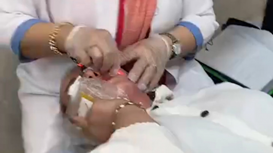 اندولیفت صورت و غبغب دکتر فرحناز زینعلی - متخصص پوست، مو، زیبایی زنجان