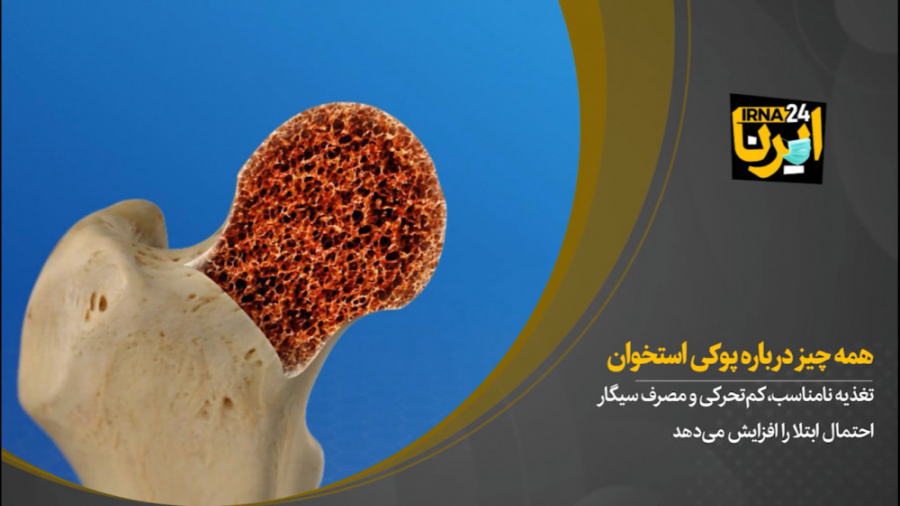 همه‌چیز درباره پوکی استخوان لیزر مو