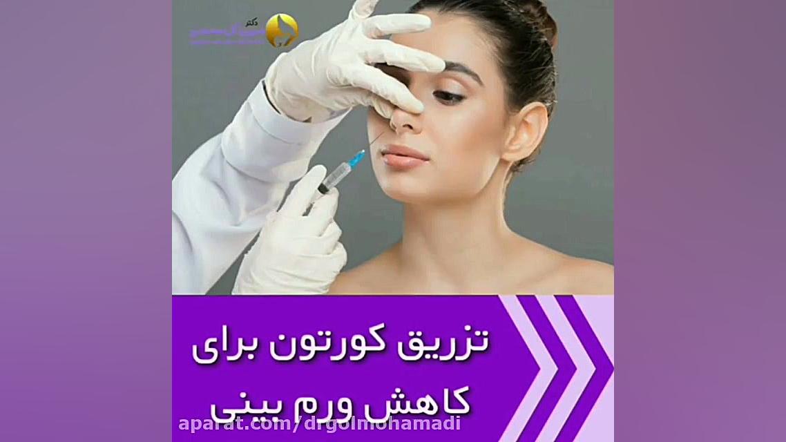 ‌تزریق کورتون برای کاهش ورم‌ بینی دندان پیش