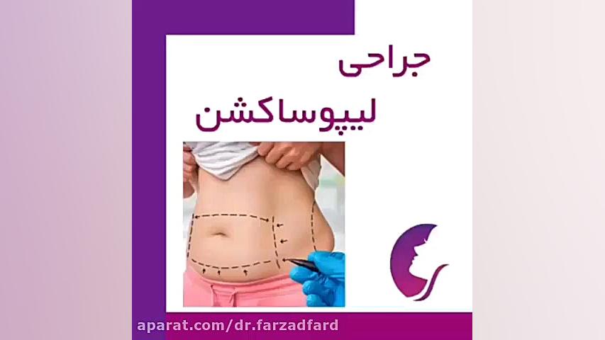 فیلم کامل جراحی لیپوساکشن را ببینید لیزر صورت