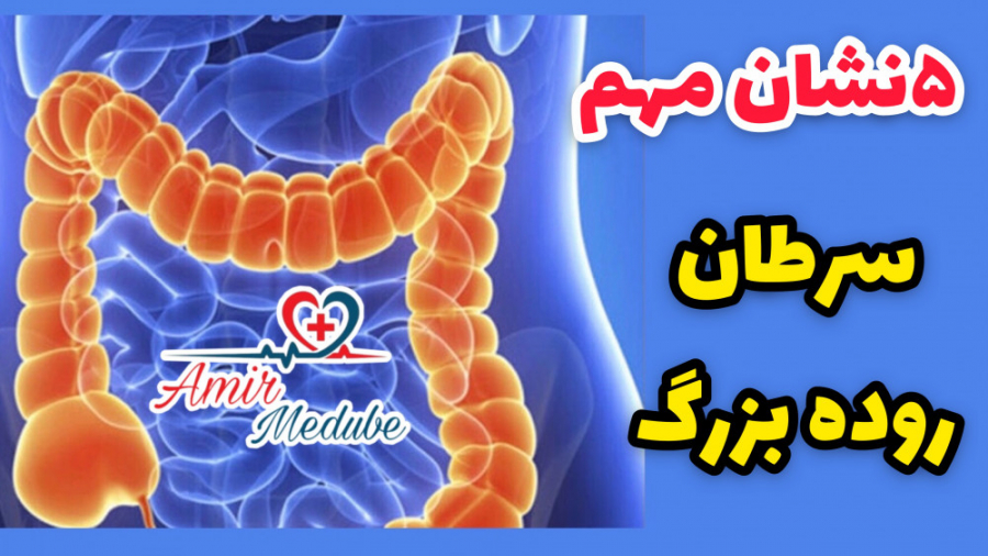نشانه های سرطان روده بزرگ چه هستند؟ لیفت گردنایمپلنت دندان