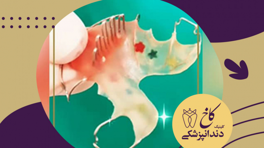 ارتودنسی متحرک کلینیک دندانپزشکی کاخ