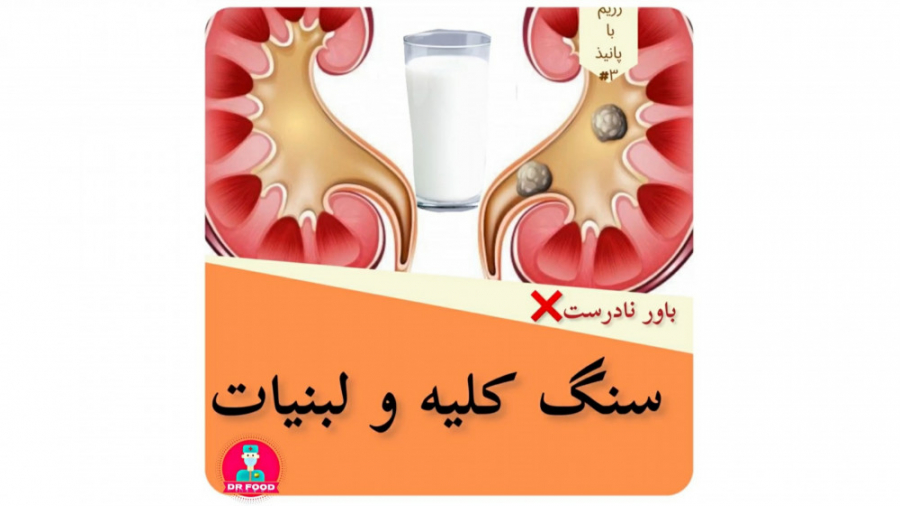 دکترفود|سنگ کلیه و لبنیات