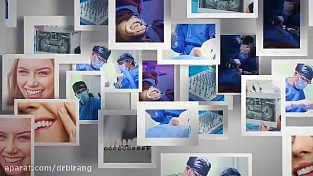 فیلم ایمپلنت گذاری دیجیتال تمام دهان به همراه روکش فوری دکتر احسان بیرنگ