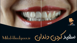 آموزش سفید کردن دندان در فتوشاپ | روتوش دندون