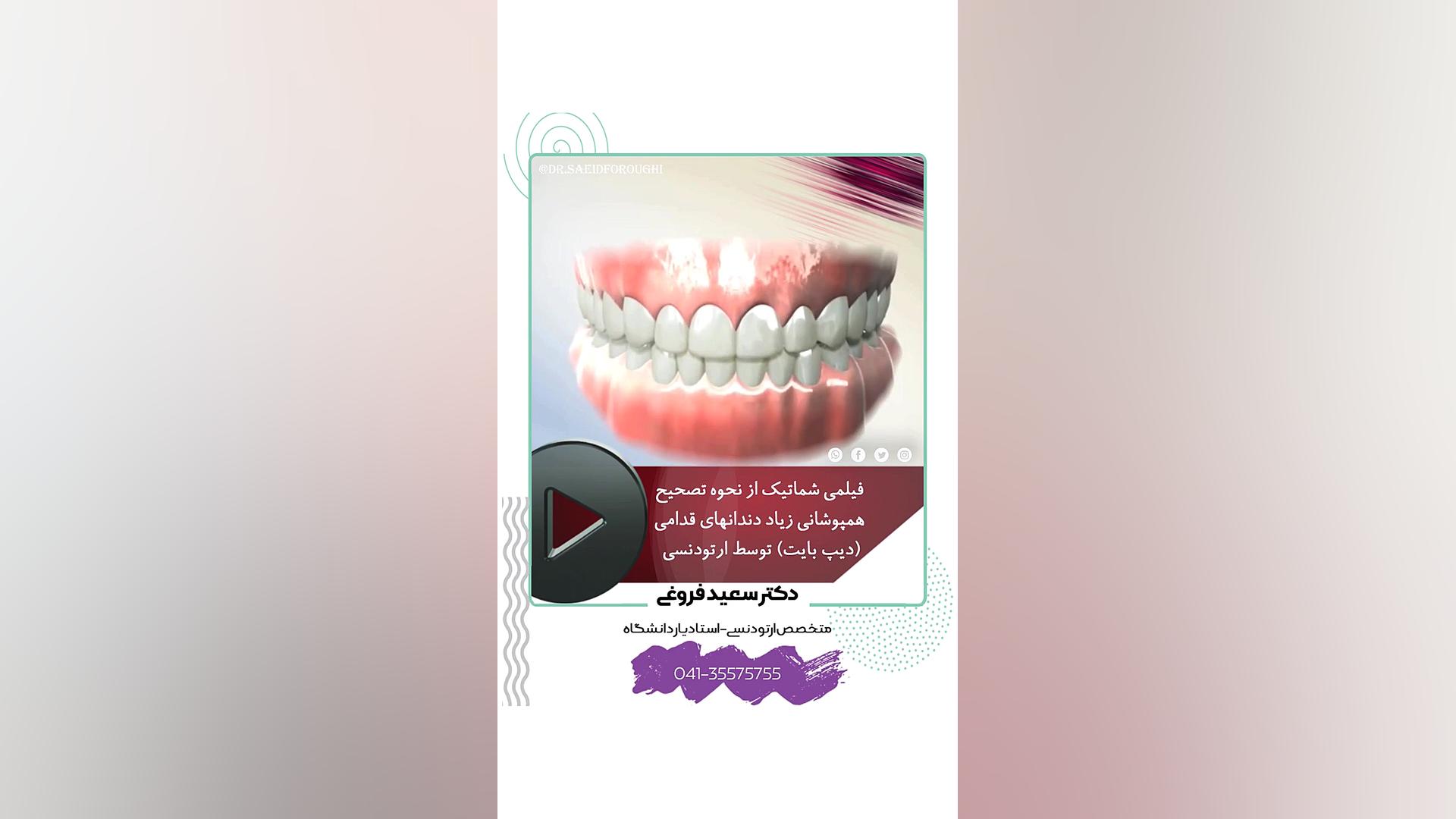 ارتودنسی دندان دکتر سعید فروغی متخصص ارتودنسی