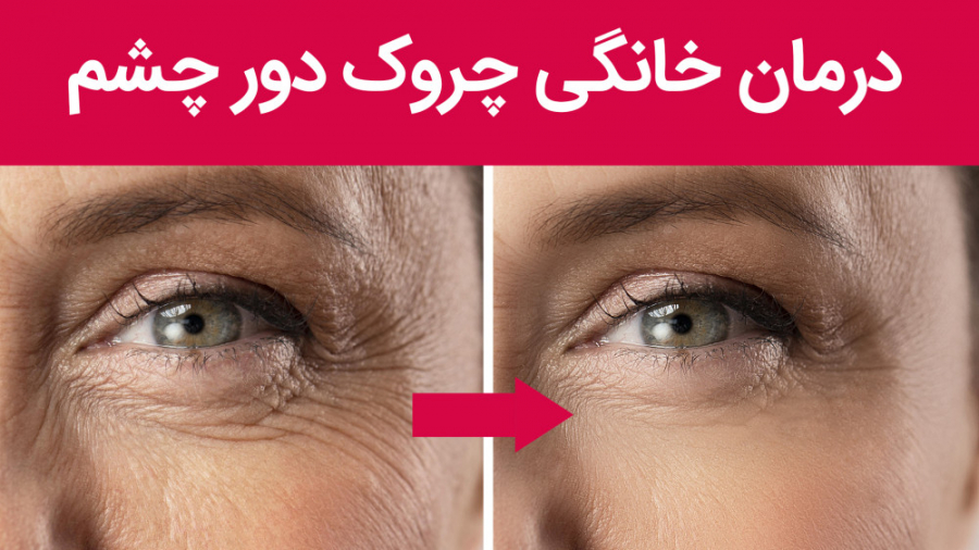 درمان خانگی چروک دور چشم | ترفندهای آرایشی