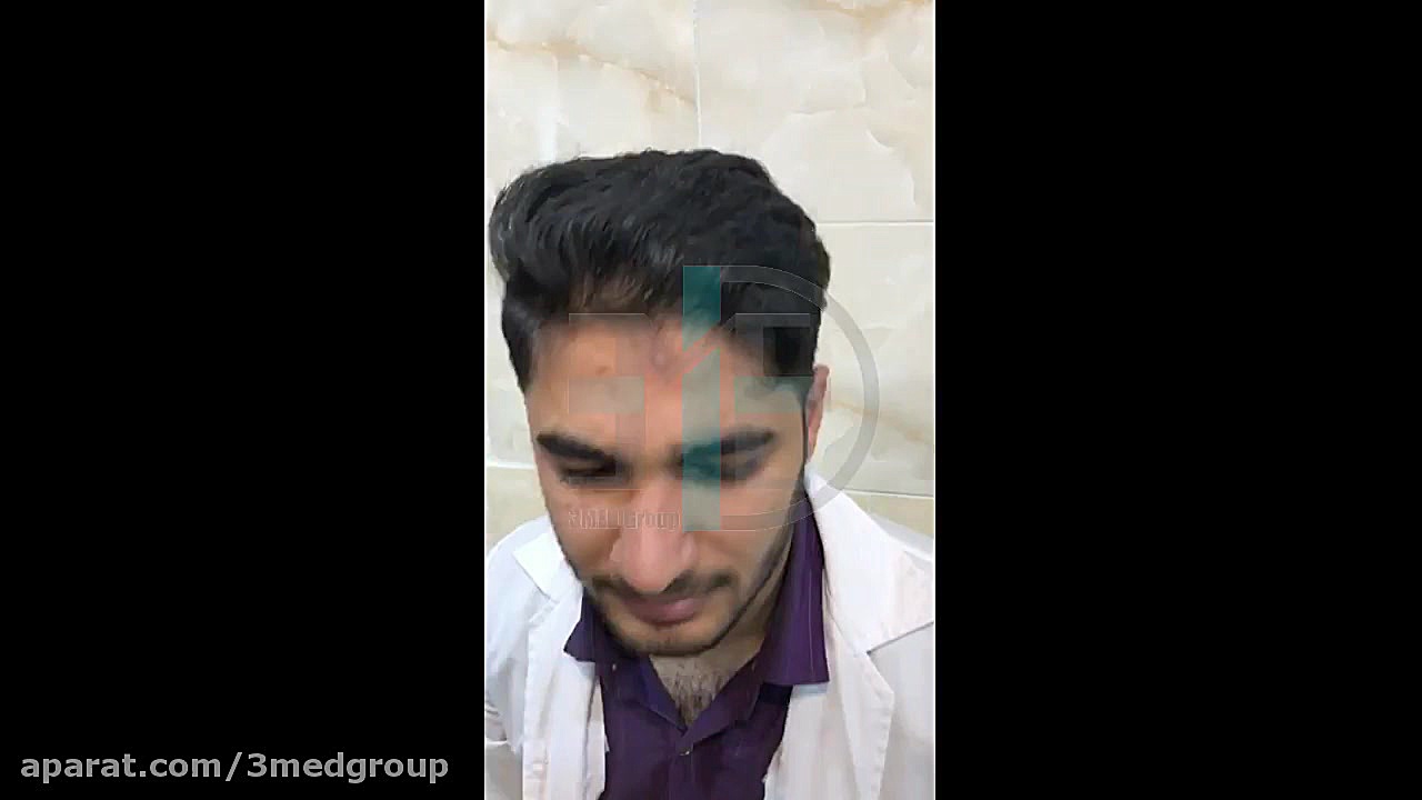 از بین بردن جای زخم با دستگاه پزشکی پلاسما الکترو سرجیکال گیمر دماغ‌آلبالویی
