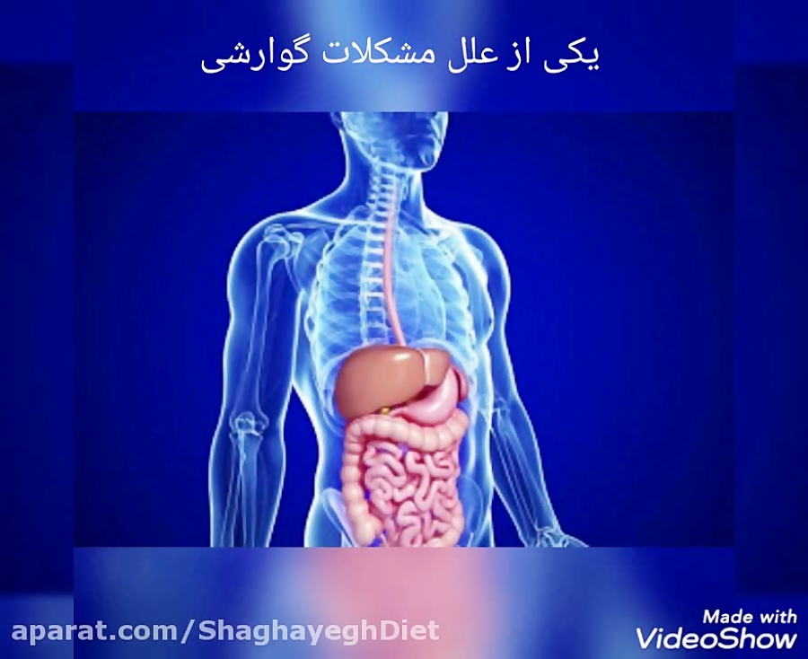 مشکلات گوارشی