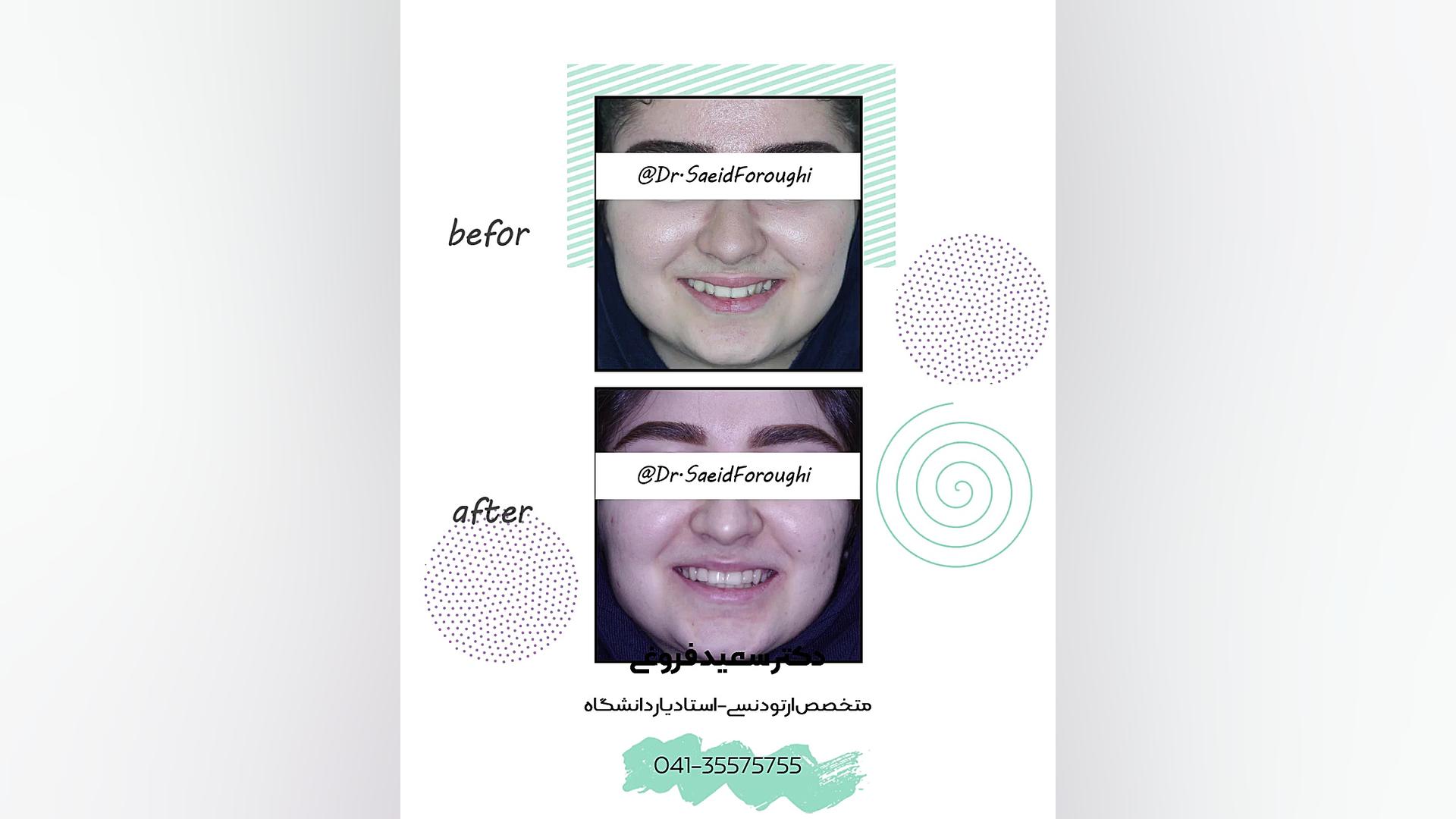 ارتودنسی دندان دکتر سعید فروغی متخصص ارتودنسی