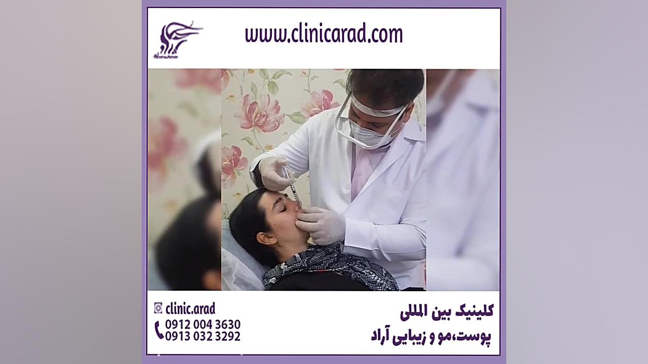 تزریق چربی بهتر است یا تزریق ژل (اس وی اف ژل) svf عمل زیبایی