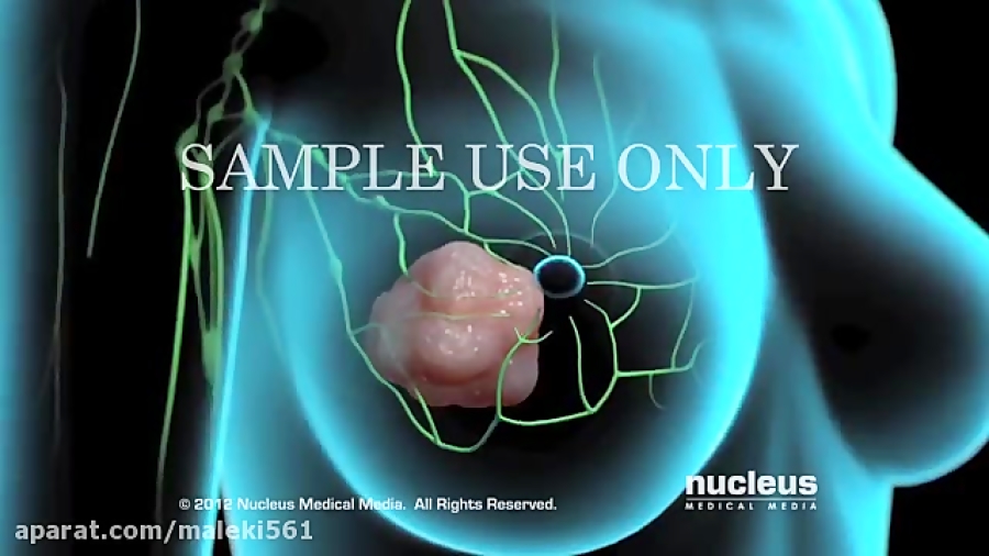 درمان سرطان و شیمی درمانی ترمیم زیبایی دندان