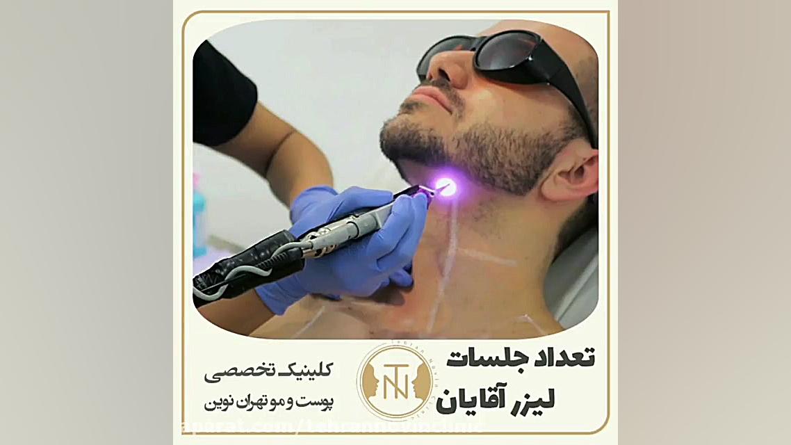 فیلم واقعی لیزر موهای زائد آقایان ASO Test