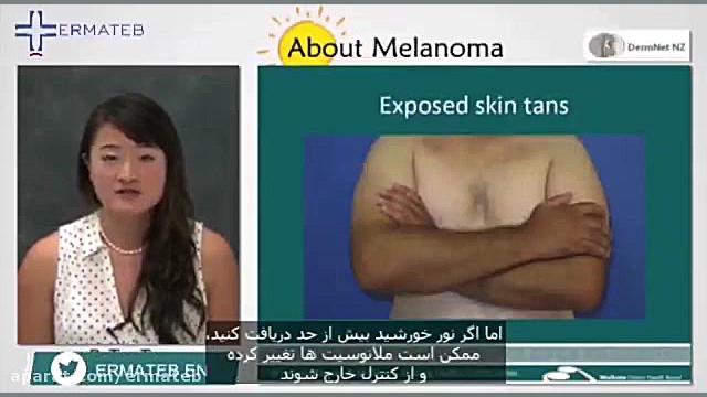 سرطان پوست برداشتن توده