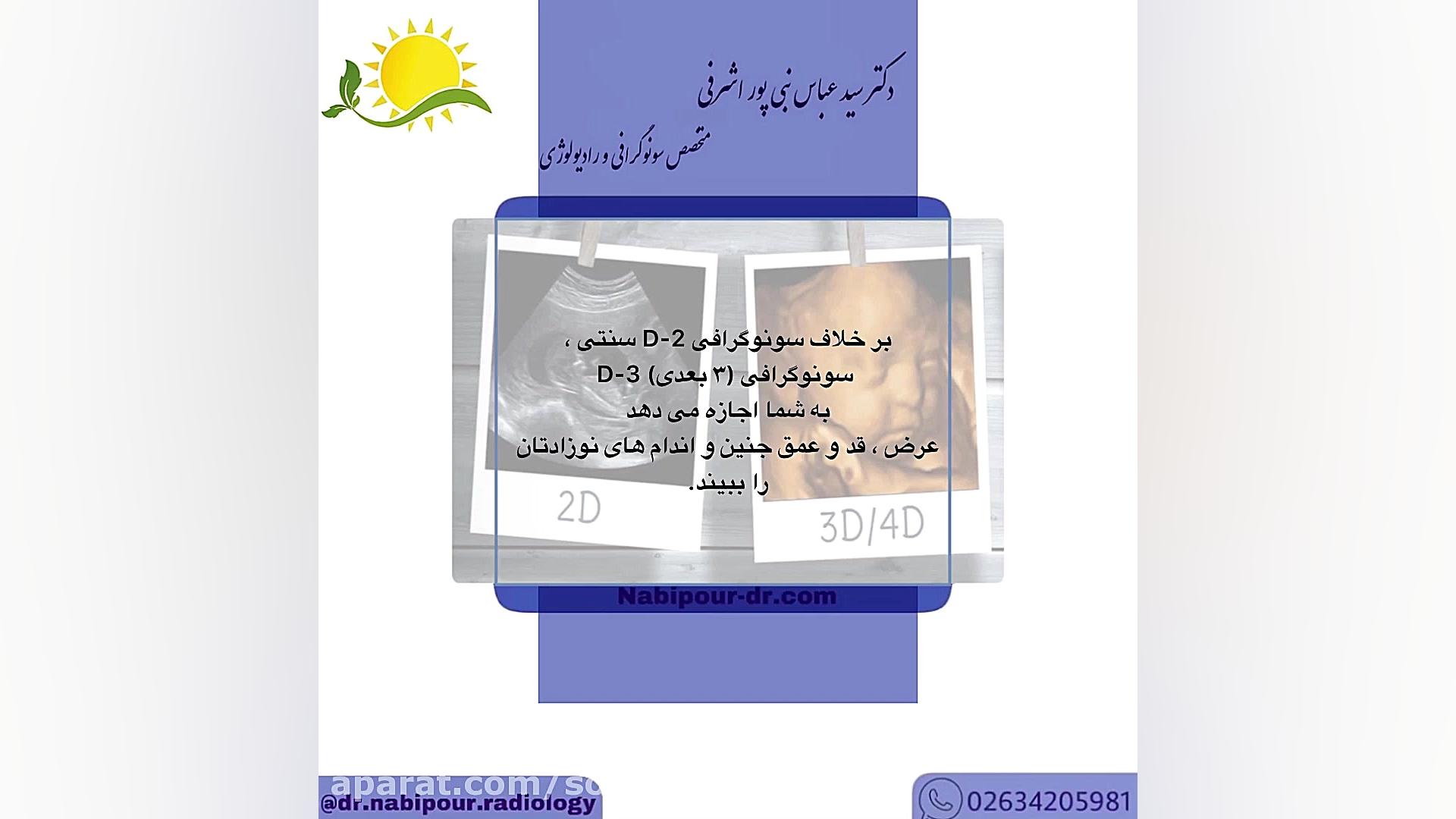 سونوگرافی ۳ بعدی و اهمیت آن در بارداری؟ یوتیوب