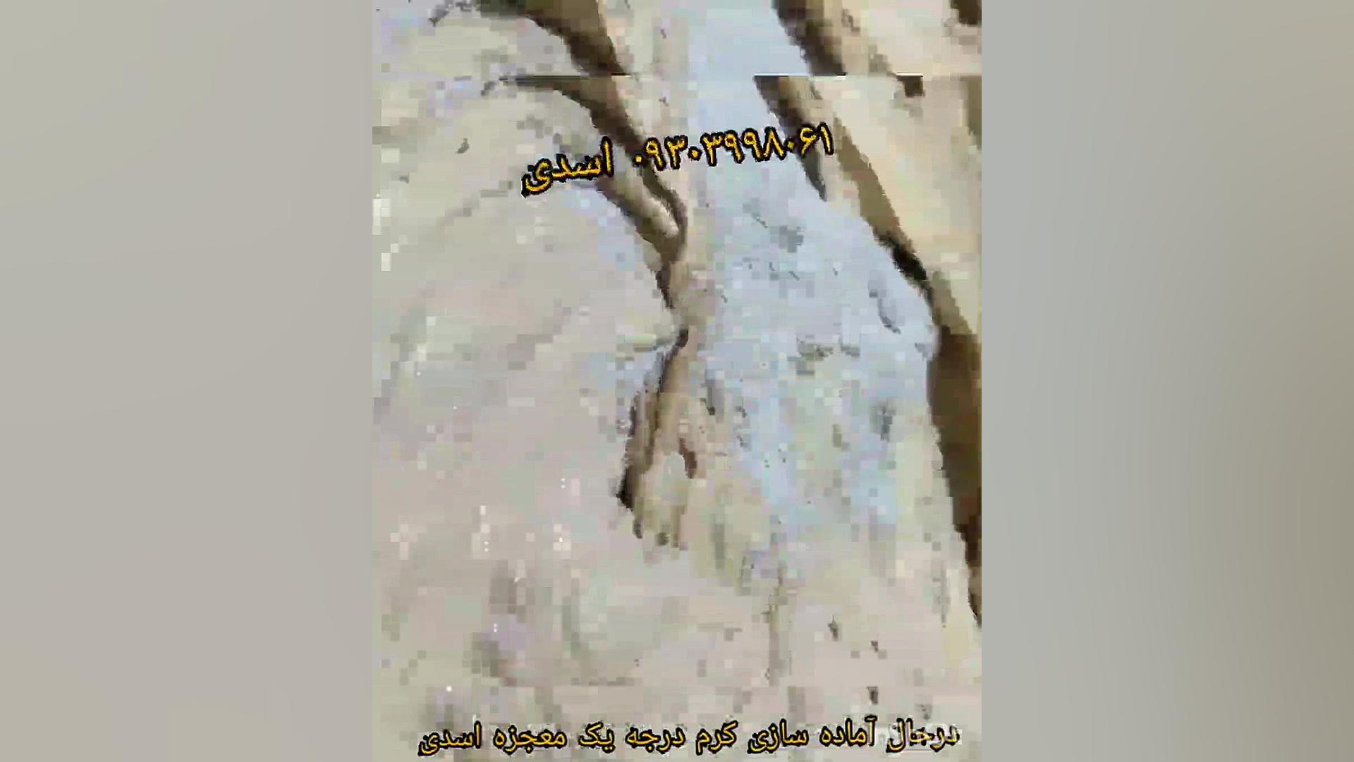 فروشگاه اینترنتی اسدی اکستنشن تاج دندان