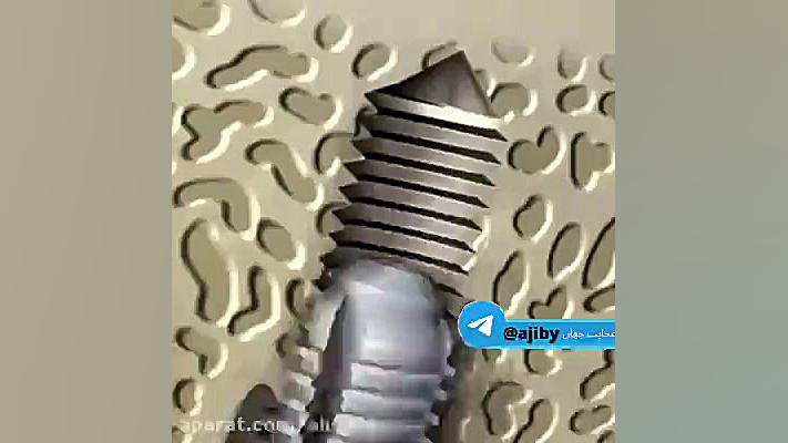 نحوه ی کاشت جالب دندان مصنوعی ابرسانی پوست