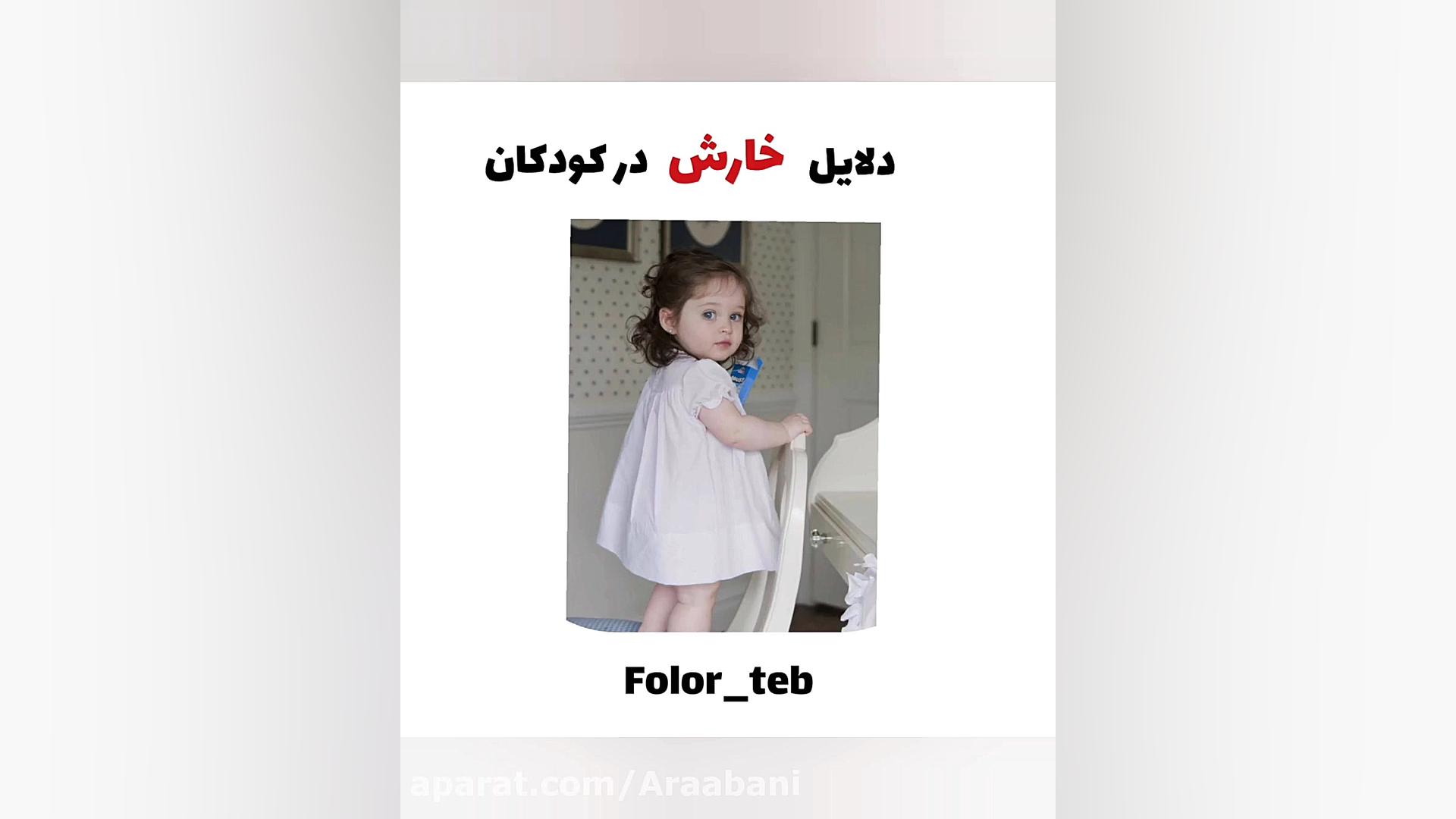 دلایل خارش در کودکان سیده سارا موسوی عربانی