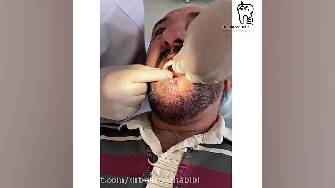 تحویل روکش دکتر بهروز حبیبی