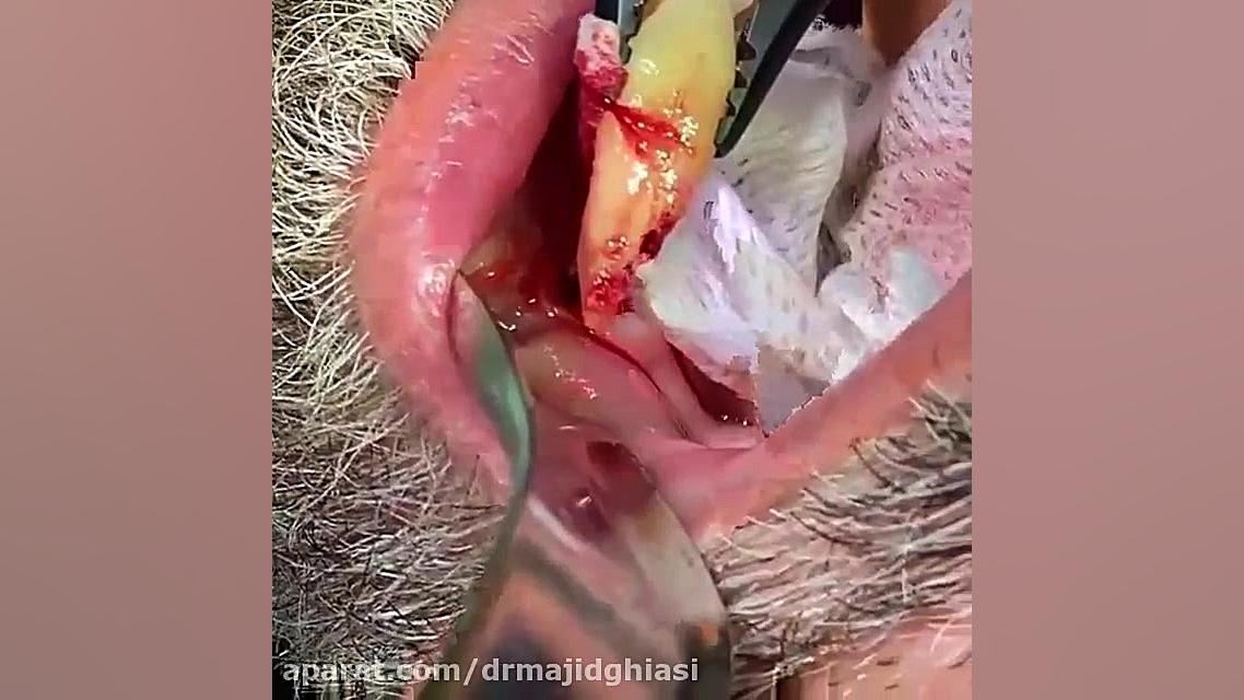 بیماری پریودنتال لثه دکترمجیدقیاسی