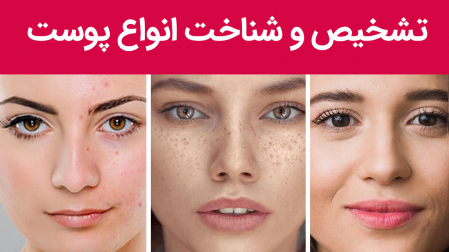 نوع پوست من چیه؟ | تشخیص نوع پوست صورت و مراقبت از آن