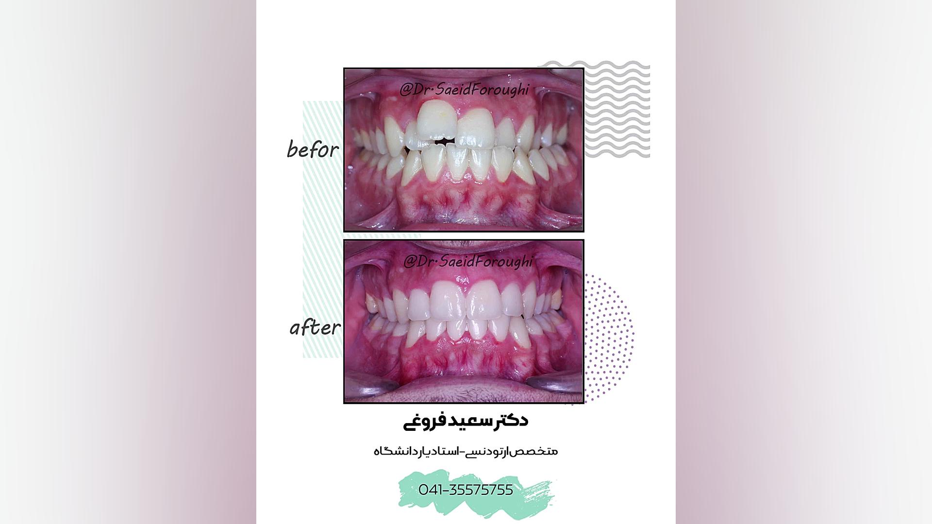 ارتودنسی دندان دکتر سعید فروغی متخصص ارتودنسی