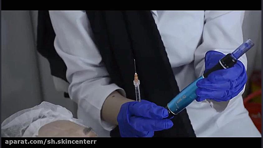 دمو دوره مجازی میکرونیدلینگ مجموعه آموزشی شقایق هپاتواسپلنومگالی