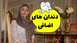 دندان های اضافی