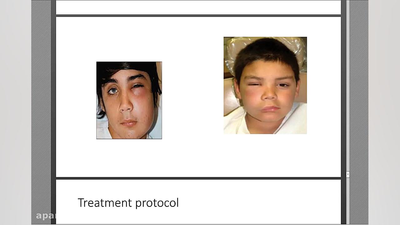 دکتر خشایار سنجری - درد و دارو در دندانپزشکی کودکان PEFR