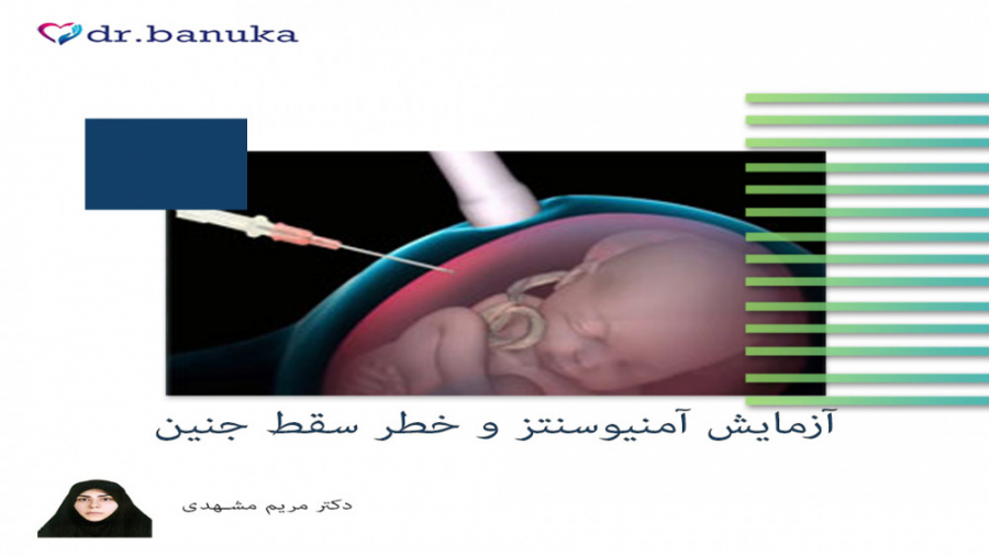 دکتر مریم مشهدی/آزمایش آمنیوسنتز و خط سقط جنین لیپوماتیک