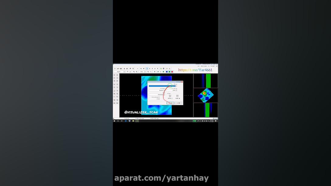 اموزش اسکن کردن ابتدا شروع کار با دستگاه اسکنر باز کردن پروژه جدید کربوکسی تراپی
