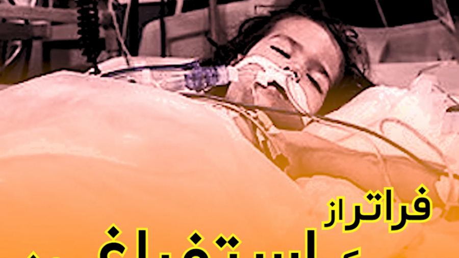 فراتر از یک استفراغ بود/دکتر سیمین یزدی پیلینگ شیمیایی