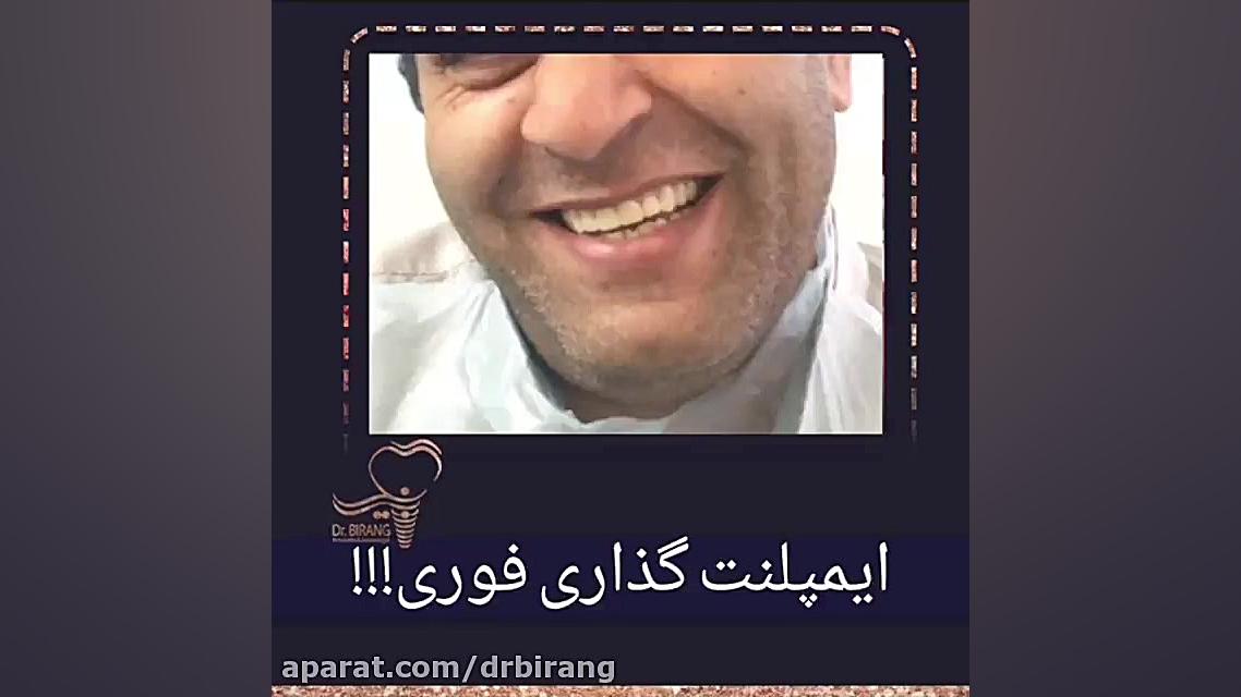 فیلم واقعی و بدون سانسور ایمپلنت فوری دکتر احسان بیرنگ
