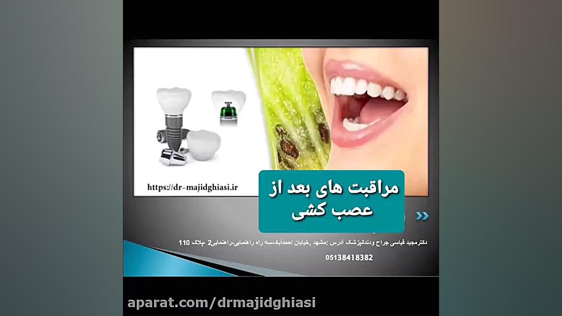 مراقبت های بعداز عصب کشی دندان دکترمجیدقیاسی