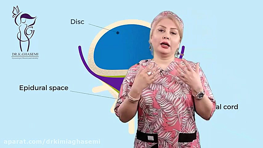 برای زایمان بی حسی از کمر بهتر است یا بیهوشی کامل؟| دکتر کیمیا قاسسمی اینسایزینگ