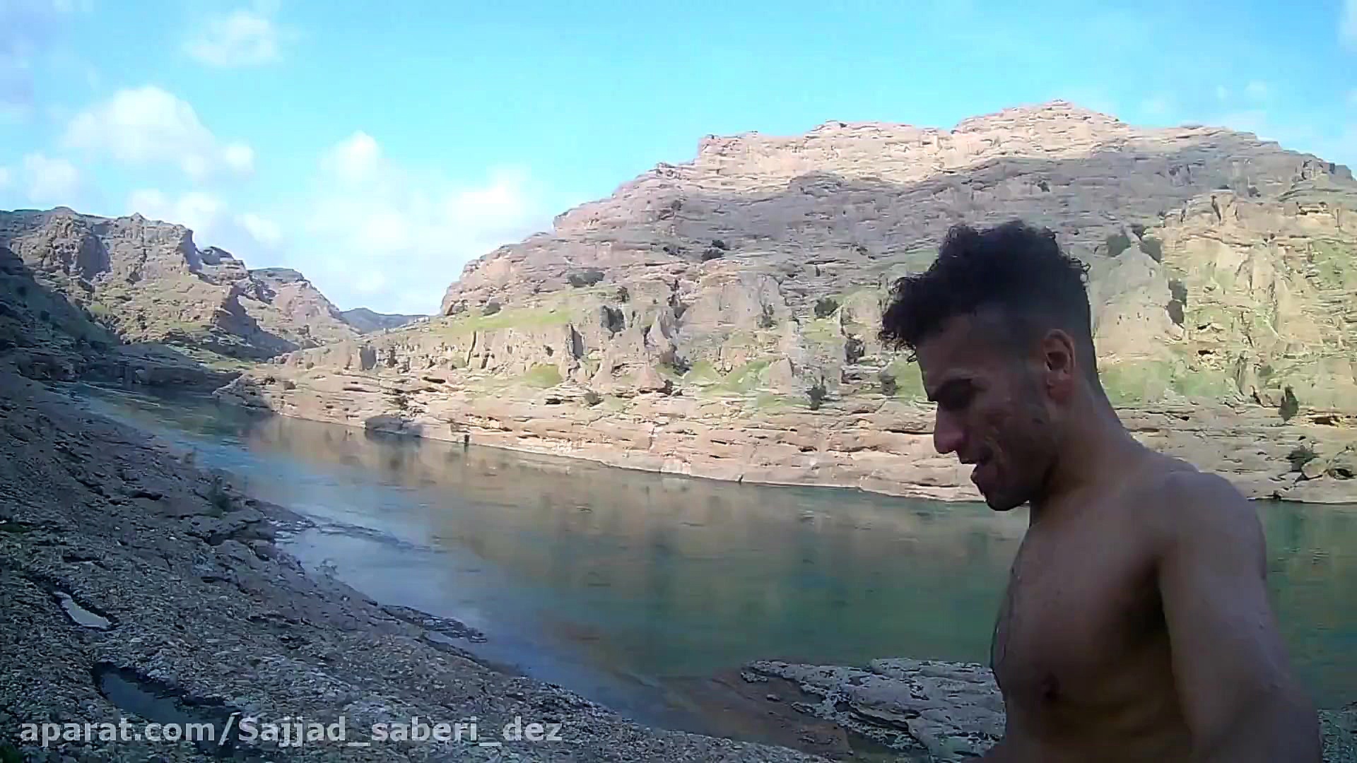 شنا وسرما ماموپلاستی