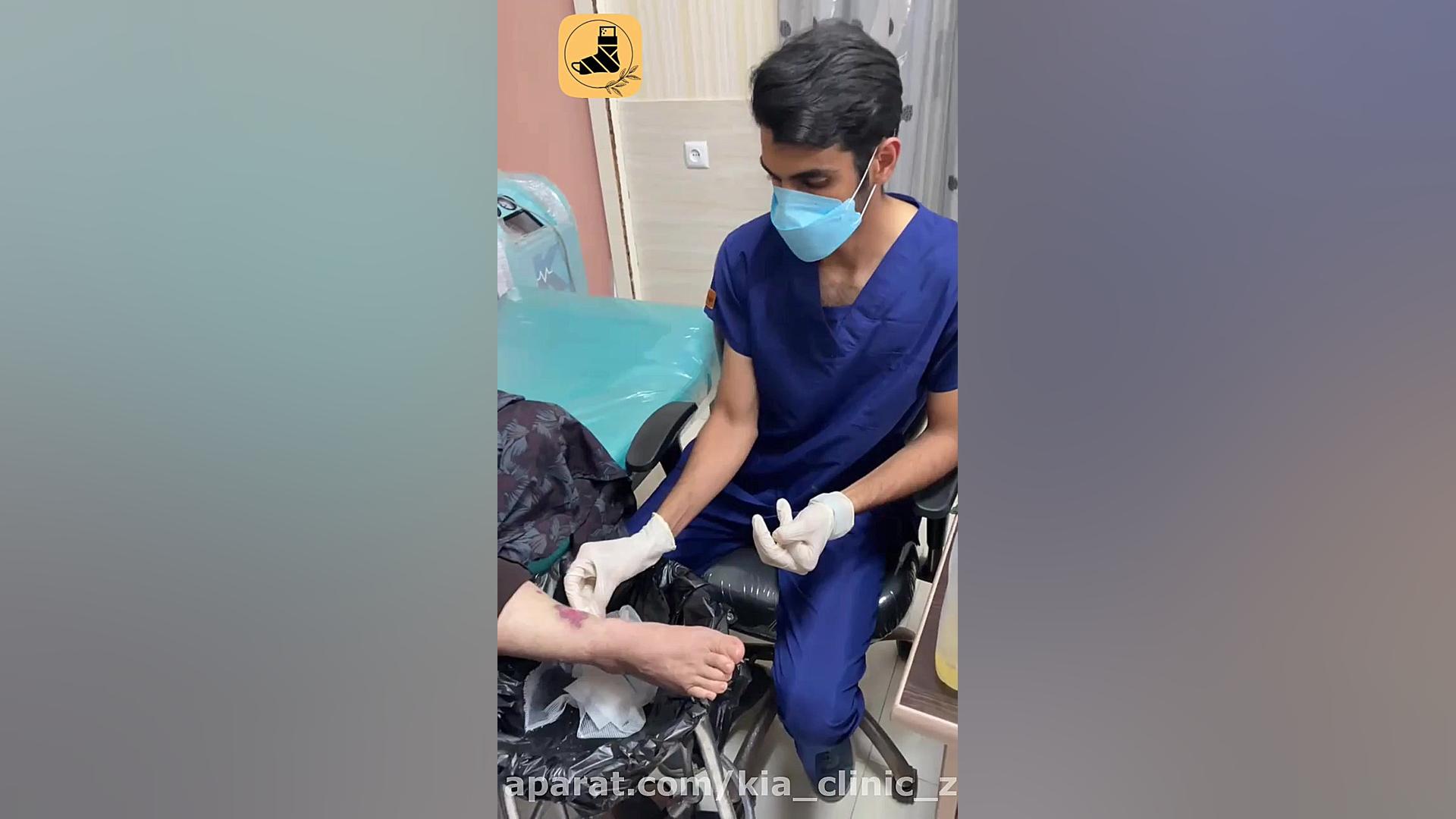 درمان زخم سوختگی مقاوم به درمان تزریق ژل