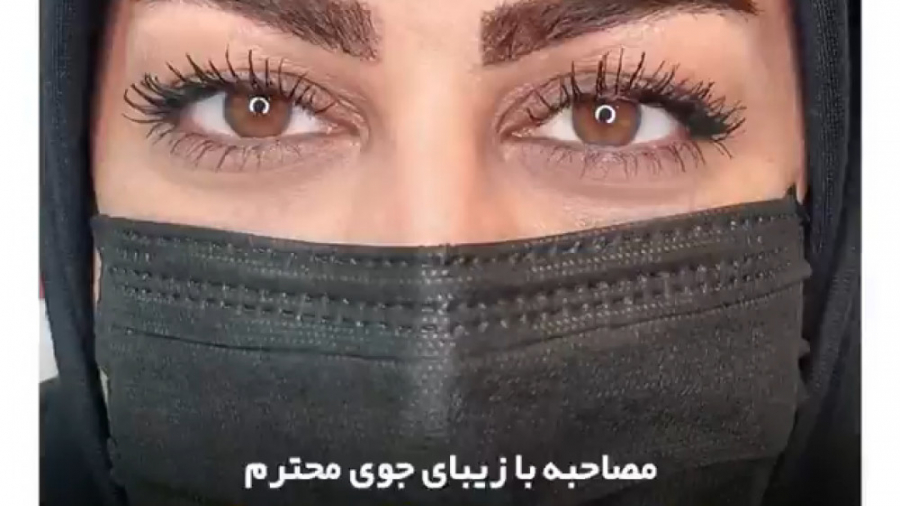 مصاحبه با زیبای جوی محترم - نتیجه کاشت ابرو پس از دو ماه ANCA