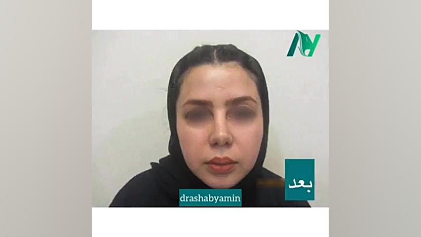 جراحی زیبایی بینی و چانه دکتر محمودرضا اصحاب یمین - فوق تخصص پلاستیک