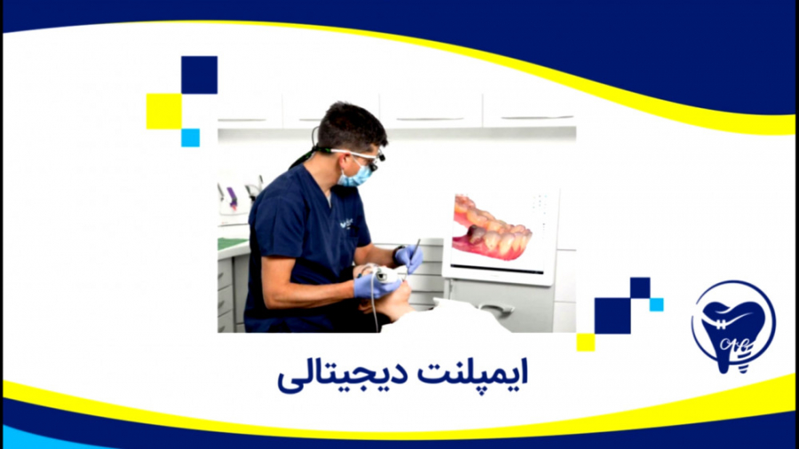 ایمپلنت دیجیتالی کلینیک دندانپزشکی دکتر عزیز گشاده رو