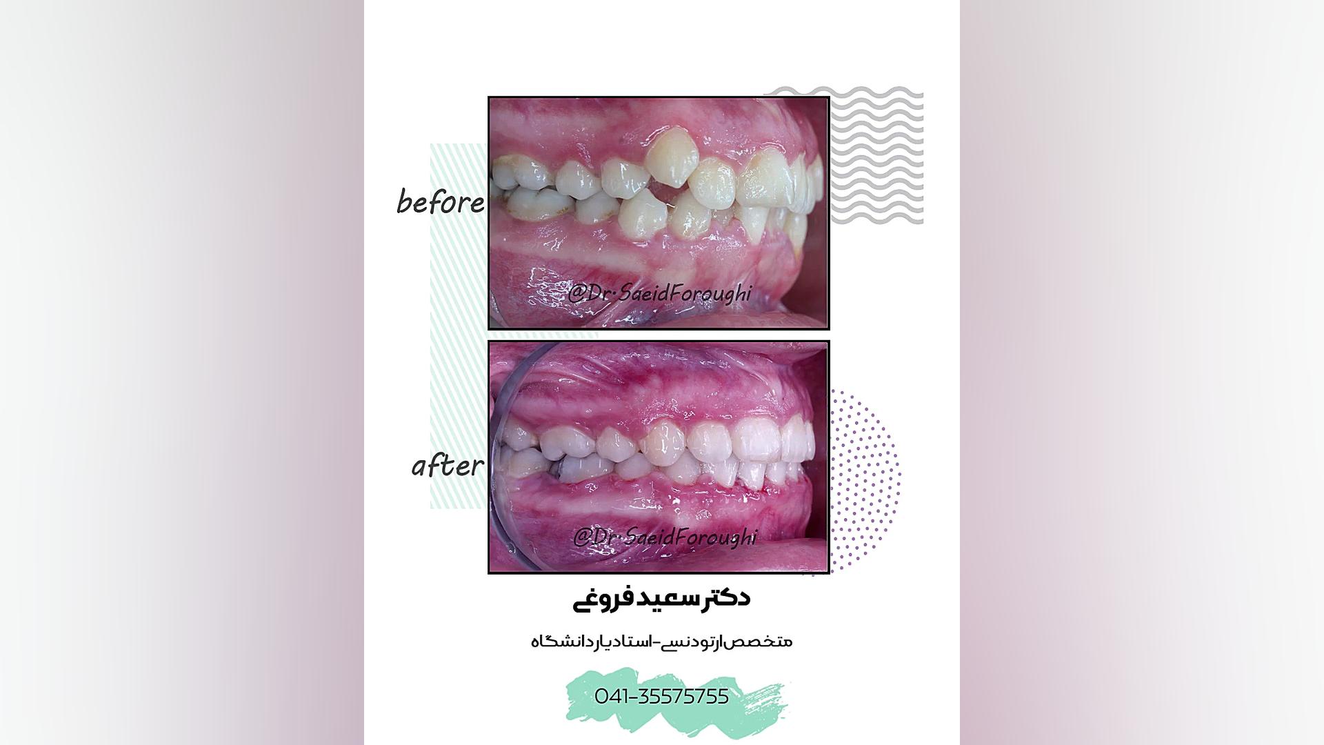 ارتودنسی دندان دکتر سعید فروغی متخصص ارتودنسی