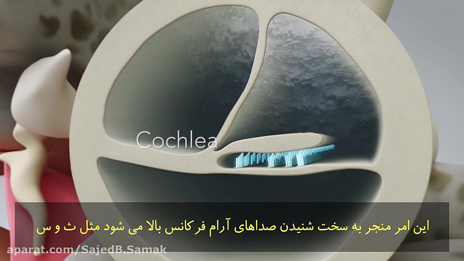 چگونه می شنویم؟ ادیولوژیست ساجد بادفر