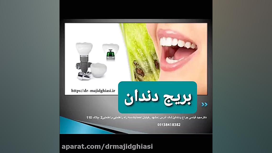 بریچ دندان دکترمجیدقیاسی